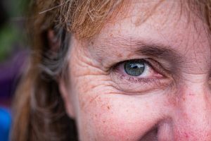 a close up of a person with freckled hair